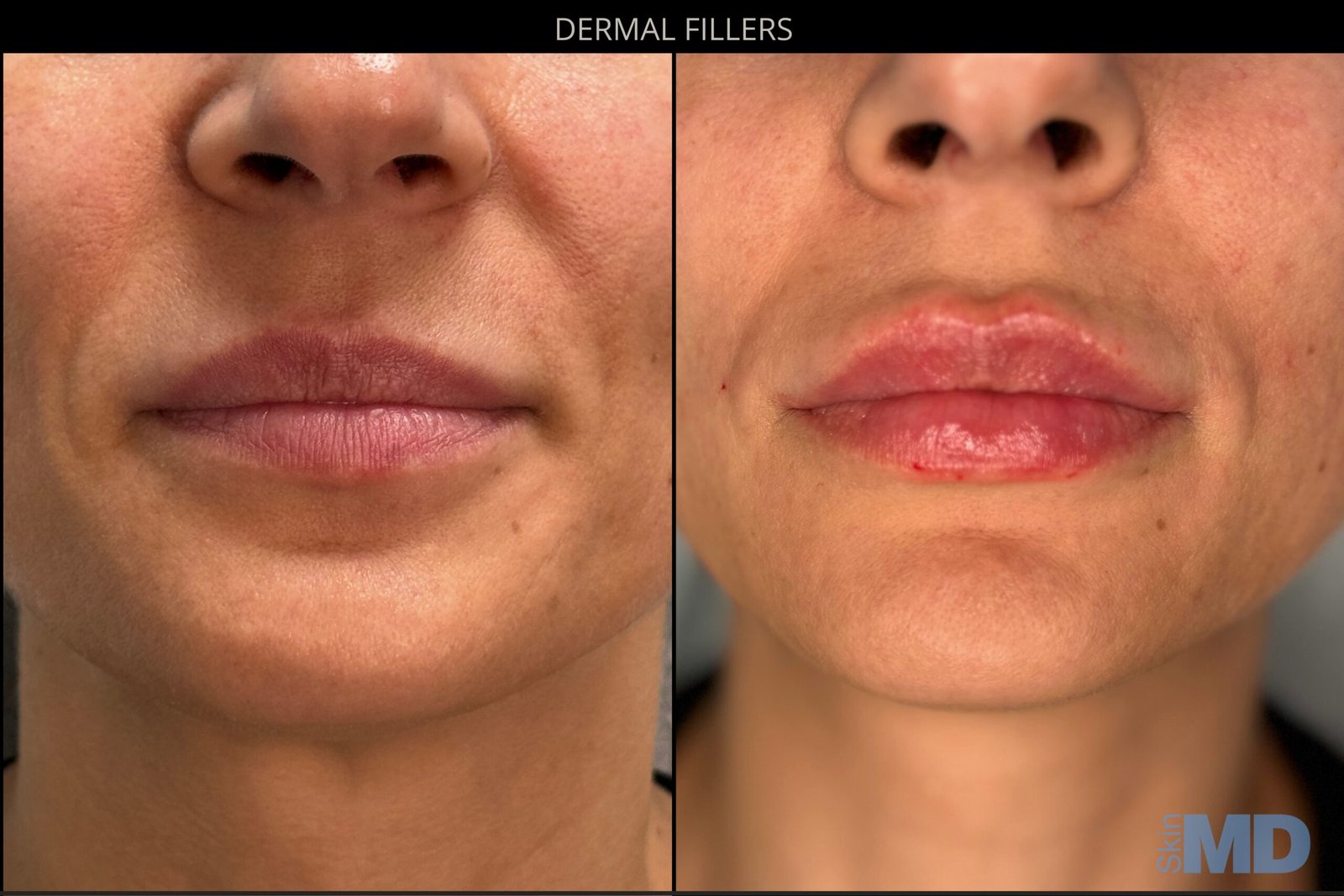 MEL-B-LIPPIES-24-scaled