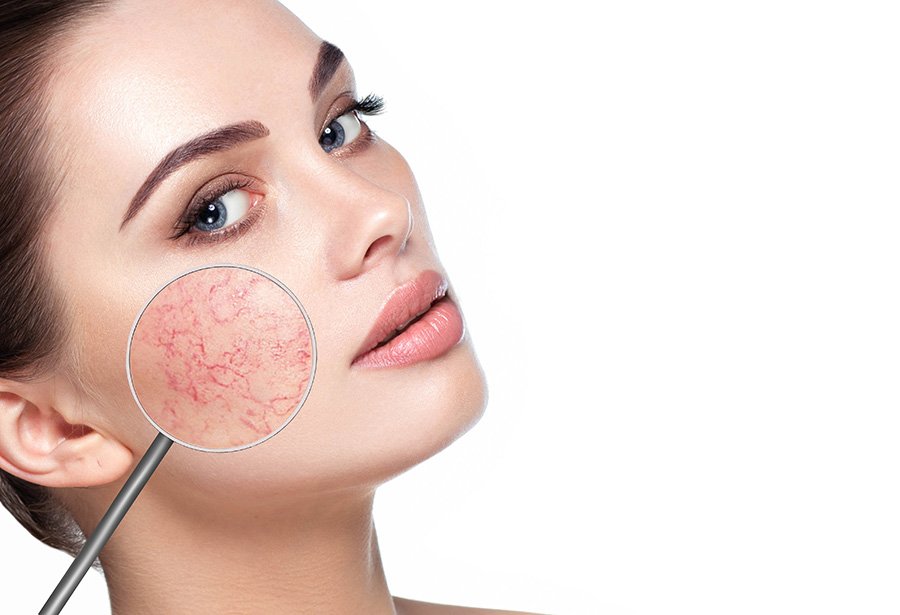 Vascular Lesions